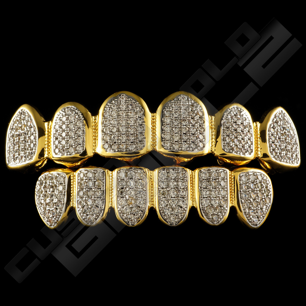 Custom Gold Grillz'