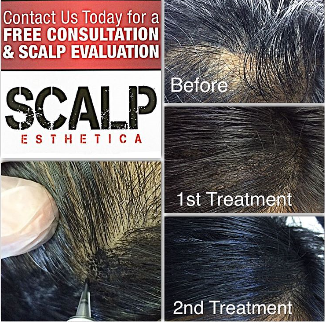 Scalp Esthetica Toronto