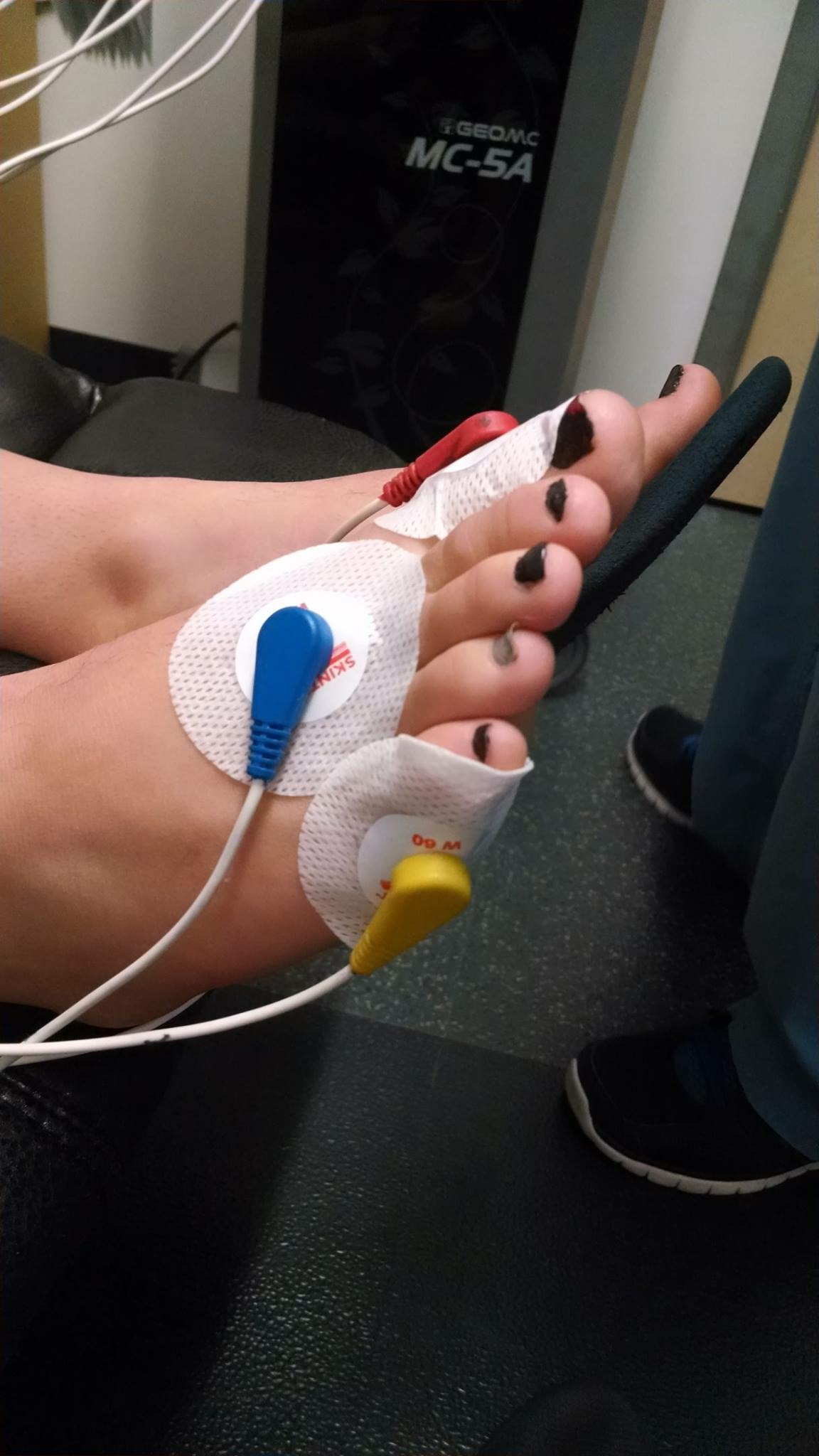 Blair Barao Treatment with Calmare'