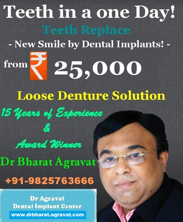 Dr_Agravat_Dental_Implant_Clinic_Ahmedabad_Mumbai_Rajkot_Ind