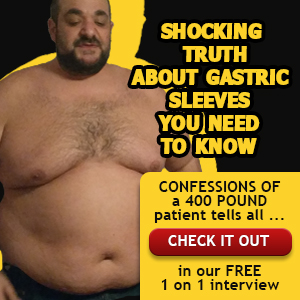 Shocking Truth about Gastric Sleeve Surgery