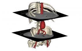 medical engineering 3D'