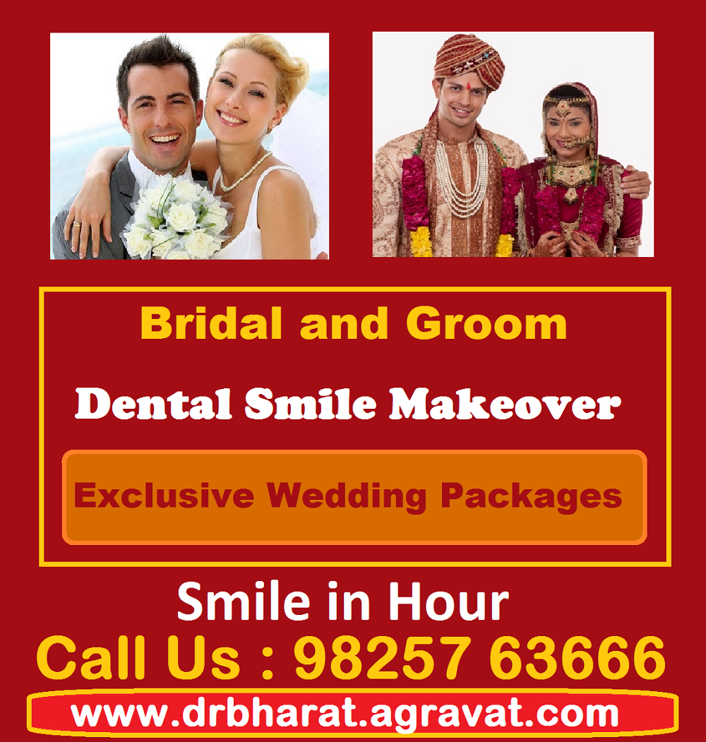 Bride_and_Groom_Dental_Smile_Makeover_Wedding_Packages_Ahmed