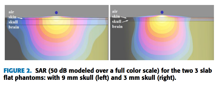 Brain models'