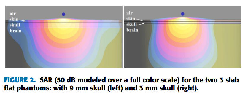 Brain models