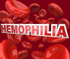 Hemophillia'