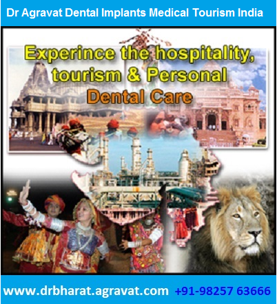 Best_place_for_Dental_Implants_Medical_Tourism_Ahmedabad_Ind'